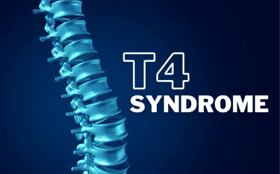 T4 Syndrome Case Study (Abstract)